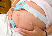 external fetal monitor