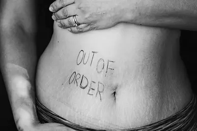 Person's stomach with "Out of Order" written on their skin.