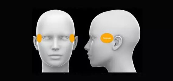 Diagram showing the temporal region beside the eyes.