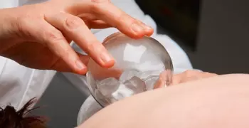 Person receiving cupping therapy. 