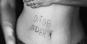 Person's stomach with "Out of Order" written on their skin.