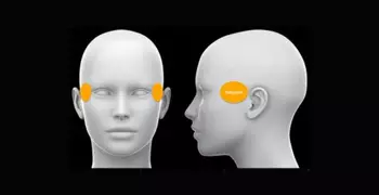 Diagram showing the temporal region beside the eyes.