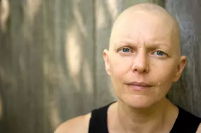 woman with no hair looking seriously into camera
