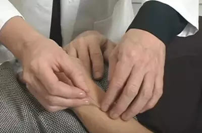 close up of an acupuncturist inserting needles in a patient's wrist