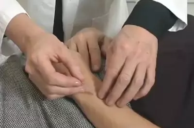 Acupuncturist's hands inserting needle on patient's arm