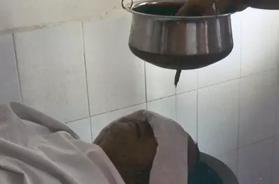 man having oil dripped on his forehead