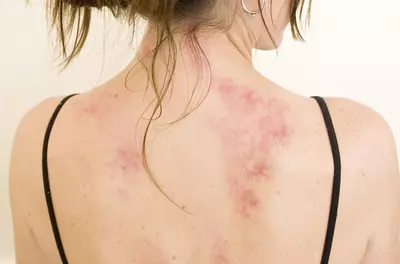 Gua Sha